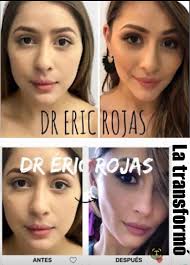 QUIERE HACERSE " FAMOSO O FAMOSA " EN TIQUICIA EN TRES DÍAS ? HÁGASE DE  PAREJA A KEYLA SÁNCHEZ O JANETH GARCÍA, COMO ANTHONY RAMIREZ O ALEJANDRO  SEQUEIRA " MANGO CELE ",