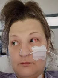 Mum nearly died after injecting herself with counterfeit 'weight loss jab'  she brought online