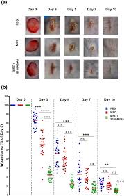 I can't say for certain if they are all 50 cal wounds though. A Novel S100a8 A9 Induced Fingerprint Of Mesenchymal Stem Cells Associated With Enhanced Wound Healing Scientific Reports