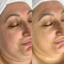 Skin and Beauty by Carissa