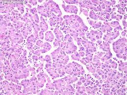 Maybe you would like to learn more about one of these? Webpathology Com A Collection Of Surgical Pathology Images