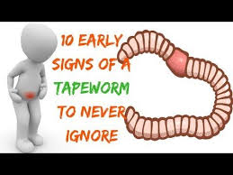 10 Early Signs Of A Tapeworm To Never Ignore Youtube Tape Worm In Humans Primary Doctor Youtube