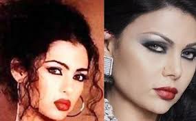 فنانات قبل وبعد التجميل.. لن تصدّقوا الفرق ( صور ) - المدينة نيوز
