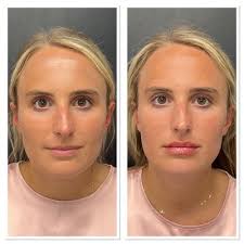 Beauty & Grace Aesthetics