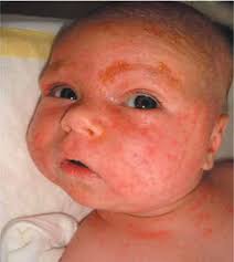 Forum: Abenteuer Jugendmedizin Fortbildung: Hörstörungen im Kindesalter