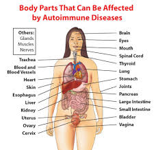 Parts of body lady name : Autoimmune Diseases Womenshealth Gov