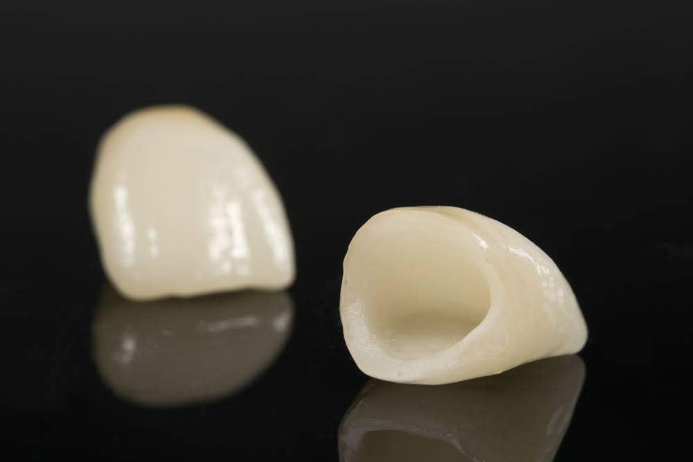 Dental Crown product image
