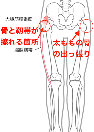 股関節を動かすと内側から音が鳴るし痛い” その症状「弾発股」かも？ | 加古川市新神野 ひさき鍼灸整骨院