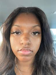 How to get rid of hyperpigmentation spots?