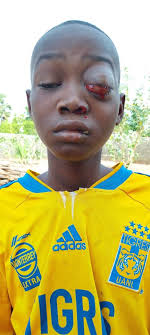 Overcoming vision problems through spiritual growth