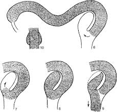 Image result for Cyperus trigonellus