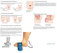 La sonde emy est pensée pour vous aider à faire vos exercices de rééducation du périnée, même habillée. Schwa Medico Urostim 2 Electrostimulateur Traitement Incontinence