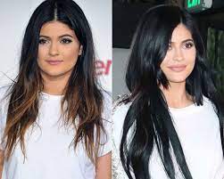 Kylie jenner has gotten plastic surgery to look more like kendall jenner and kim kardashian according to experts. Kylie Jenner Before And After Has She Had Work Done Photos Hollywood Life