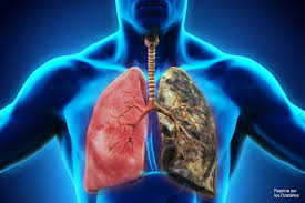 Semiología pulmonar