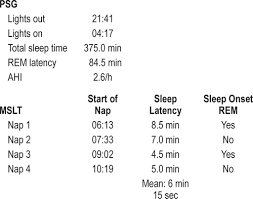 Second Opinion Does This Patient Really Have Narcolepsy Journal Of Clinical Sleep Medicine