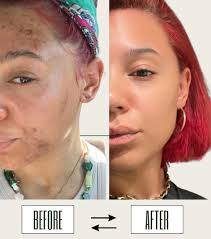 Vanessa Hernandez Skincare (@vhskin) • Instagram photos and videos