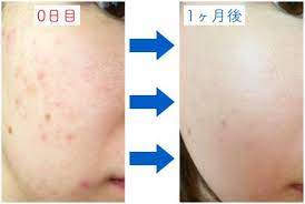 記事番号 576 アイテムid 51523の画像 ニベア スキンケア 平子理沙