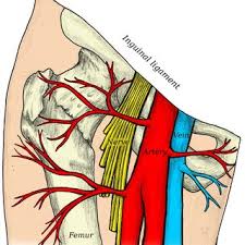 Several groin muscles are attached to the femur bone in the upper part of the leg. Show Me The Groin Area Ultrasound Video Showing Inguinal Hernia With Gut Loops Tenda Ruangan
