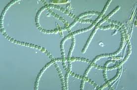 Resultado de imagem para Anabaena sp - cianobactÃ©ria