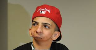 Joven sin mandíbula que escribe rap es nominado en premios para inspiradores