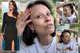 Melanie Sykes reveals devastating health battle while showing bald spot