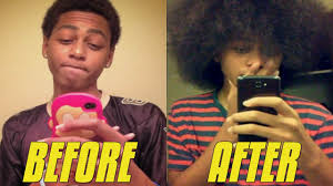 Your hair will grow faster and thicker, and if you are struggling with dandruff, you'll be catching two bunnies in one run! How To Grow Your Hair Faster And Longer For Men Women Youtube