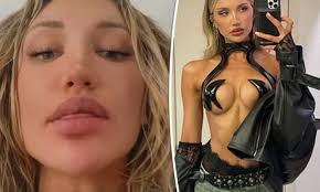 Model Gabrielle Epstein looks worse for wear after enjoying Coachella |  Daily Mail Online