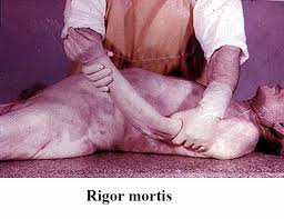 How does temperature affect rigor mortis? Learn Rigor Mortis Summation Effect And All Or None Law In 2 Minutes