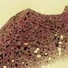 In a cross section of a bone we can see two types of bone tissue: 1