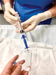 Image result for Bone Marrow Exam