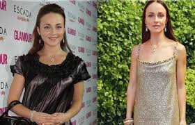 Девушка неудачно упала на улице. Stali Toshie I Ne Cimpatichnye Nezdopovyj Vid Zvyozd Posle Pohudeniya