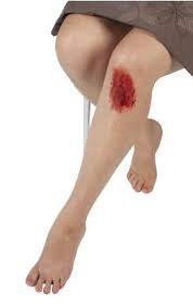 Someone is stabbing the delicate area of your inner elbow [or if you are unlucky, the as such, blood tests don't hurt. St John Guide To First Aid For Bleeding