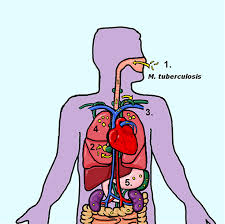 The bacteria that cause tuberculosis are spread from person to person through tiny droplets released into the air. Frontiers Mycobacterium Tuberculosis Dissemination Plays A Critical Role In Pathogenesis Cellular And Infection Microbiology