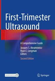 Image result for First Trimester Ultrasound