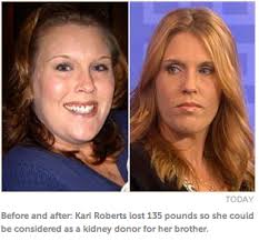 Organ and Tissue Donation Blog℠: September 2011