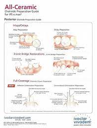But there is still a large amount of confusion as to the options and features of the various materials and styles of crown. Ceramic Restoration Dental Restoration United States