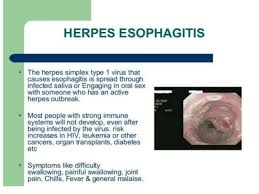 An immunocompromised state, the more commonly seen manifestations are oral candidiasis or hsv or cmv esophagitis. Herpetic Esophagitis