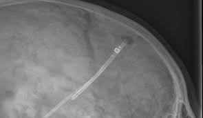 Finns även med inbyggd antisifon. Epos Trade