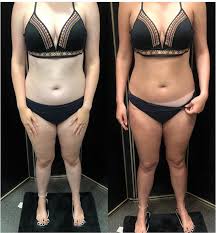 Sunless Tan Before After Pictures What To Expect Norvell