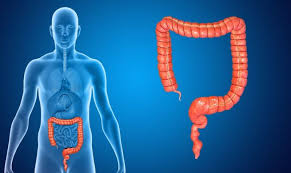 If you notice blood on the toilet paper, in the toilet bowl or mixed in with your stool, tell your doctor. The Difference Between Colon Cancer And Hemorrhoids