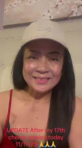 Update: After my chemo session today 11/27/25. Please include me in yo...