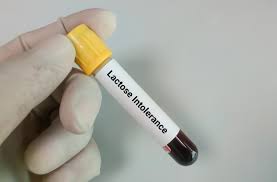 Image result for Lactose Tolerance Test