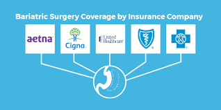 Recently, medicare expanded its coverage to include vertical sleeve gastrectomy. Pin On Weight Loss Surgery Insurance