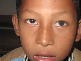 Nyacho Pauwa School, Changu Narayan