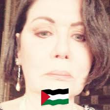 Does lupus cause dizziness and high blood pressure?