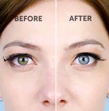 You may wash and rinse with tap water, but you do not want tap water in the lash shampoo mixture. Make Fake Eyelashes Look Good As New In Minutes By Soaking Them In Micellar Water