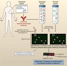 The mmse test can be used by clinicians to help diagnose dementia and to help assess its progression and severity. Blood Test For Alzheimer S