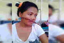 Babae Tinaga Sa Mukha Ng Kaniyang Mister Sa Zamboanga