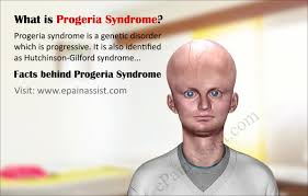 Progeria Syndrome Facts Causes Symptoms Life Expectancy