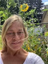 short hair styles for women after stress related hair loss